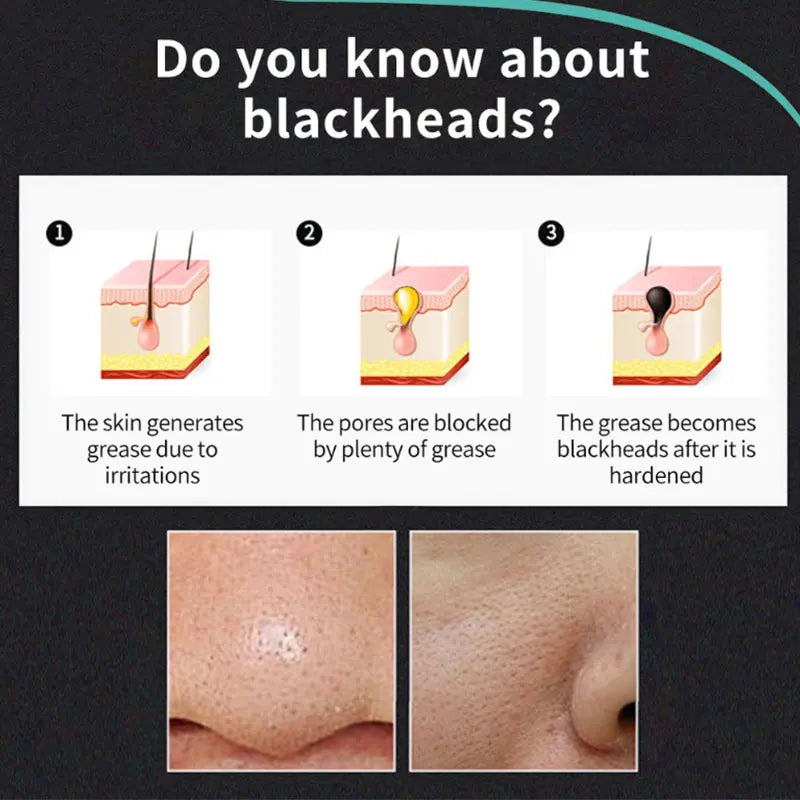 Blackhead Remover Mask Shrinking Pore Deep Cleaning Hydrating Mask Improve Rough Skin Pores Peel Off Mud Mask Korean Skincare